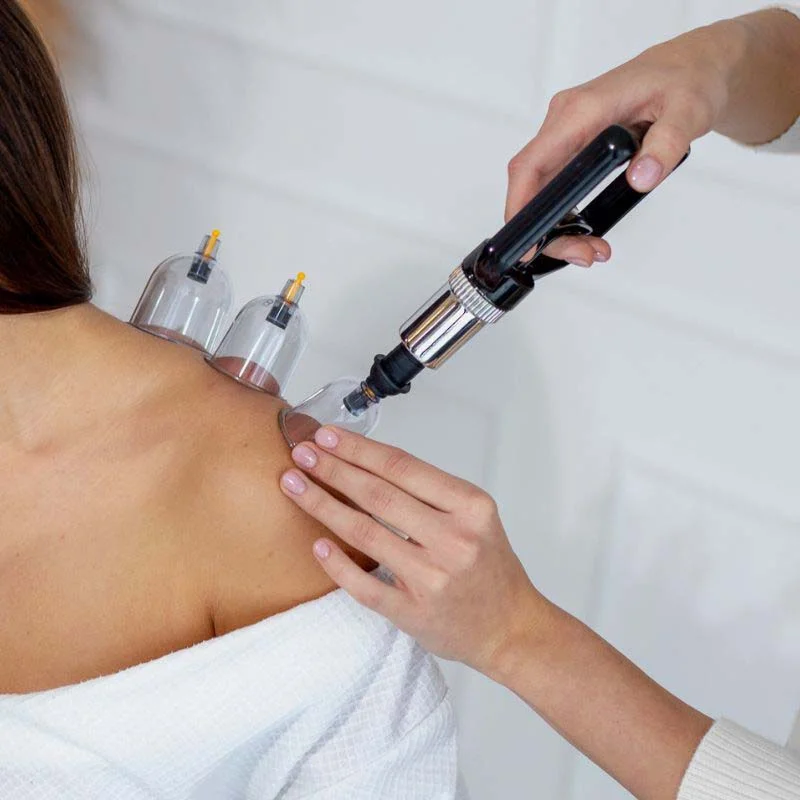 Vákuové banky - sada 20 kusov s kufríkom – Obrázok 2